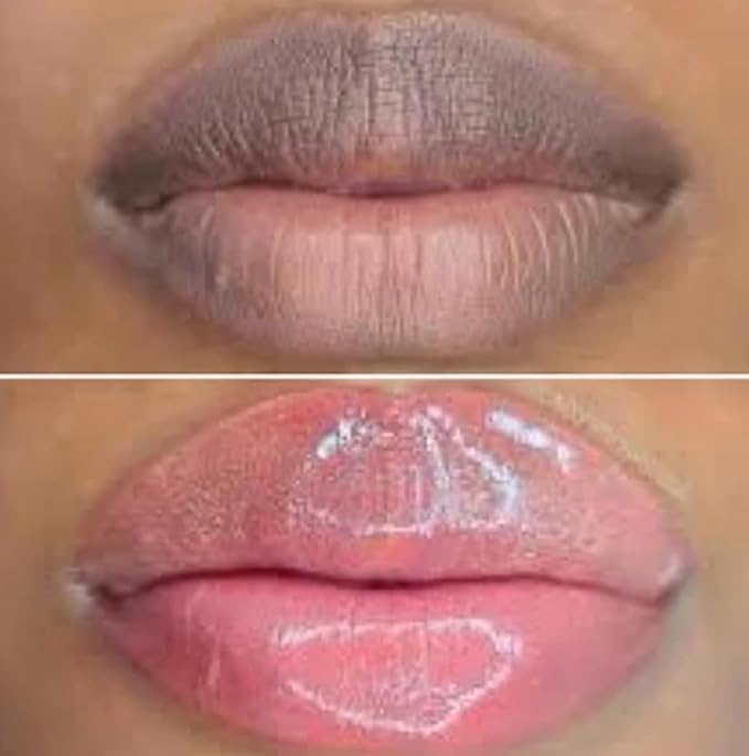 Nuvira Dark Lips Brightening Cream, Lip Lightening for Dark Lips, Nuvira Dark Lip Cream, Nuvira for Dark Lips, Lip Balm for Dark Lips Treatment for Smokers, Lip Exfoliator Softening & Hydration (1 pc)