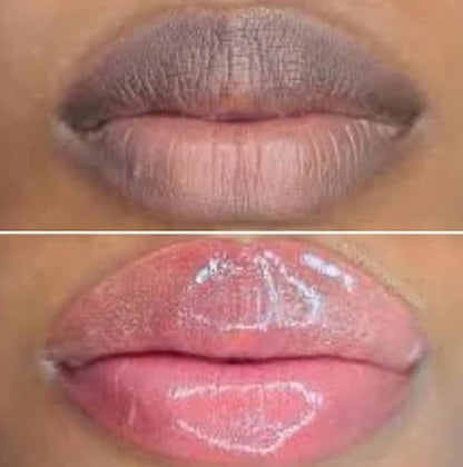 Nuvira Dark Lips Brightening Cream, Lip Lightening for Dark Lips, Nuvira Dark Lip Cream, Nuvira for Dark Lips, Lip Balm for Dark Lips Treatment for Smokers, Lip Exfoliator Softening & Hydration (1 pc)