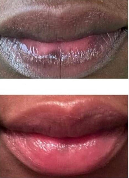 Nuvira Dark Lips Brightening Cream, Lip Lightening for Dark Lips, Nuvira Dark Lip Cream, Nuvira for Dark Lips, Lip Balm for Dark Lips Treatment for Smokers, Lip Exfoliator Softening & Hydration (1 pc)