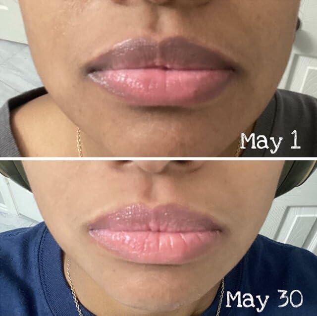 Nuvira Dark Lips Brightening Cream, Lip Lightening for Dark Lips, Nuvira Dark Lip Cream, Nuvira for Dark Lips, Lip Balm for Dark Lips Treatment for Smokers, Lip Exfoliator Softening & Hydration (1 pc)