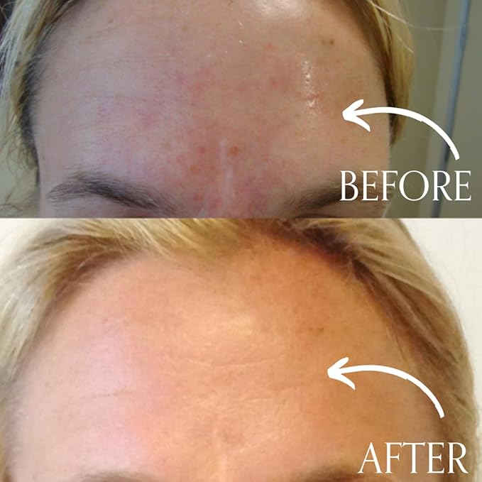 Radical Skincare Age-Defying Exfoliating Pads - Remove Dead Skin, Even & Brighten Skin Tone for Radiant Glow - For All Skin Types Including Sensitive Skin - Paraben & Cruelty Free (60 Pads)