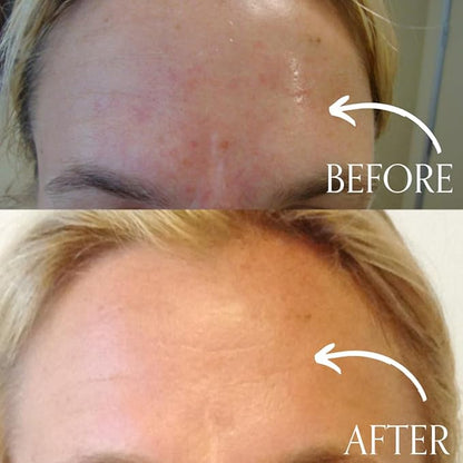 Radical Skincare Age-Defying Exfoliating Pads - Remove Dead Skin, Even & Brighten Skin Tone for Radiant Glow - For All Skin Types Including Sensitive Skin - Paraben & Cruelty Free (60 Pads)