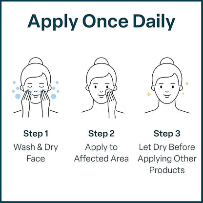 QRxLabs Glycolic/Salicylic Acid 10/2 Acne Control Pads with 10% Ultra Pure Glycolic + 2% Salicylic Acid, Allantoin, Vitamins B5, C & E, Calendula Green Tea - Most Effective Treatment Clear Skin - 2PK