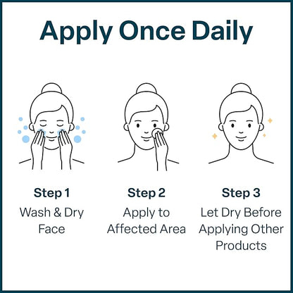 QRxLabs Salicylic & Glycolic Acid Pads (2% Salicylic & 10% Glycolic) - Acne Pads for Face & Bacne with Vitamins B5, C & E, Calendula & Green Tea - Face Exfoliator - 50 Count Jar