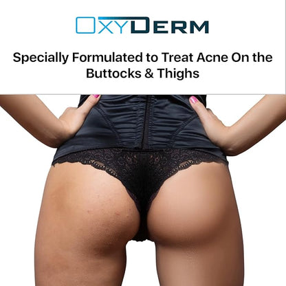Butt & thigh Acne Treatment Pads - Exfoliating Pads to Eliminate Acne Causing Bacteria. Removes Pimples, Blemishes & Ingrown Hairs for the Buttocks & Thigh Area for Both Men & Women.