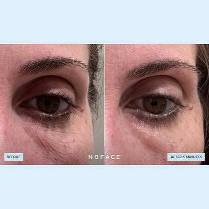 NuFACE IonPlex Hydra-Gel Power Under Eye Patches - Gel Under Eye Mask for Puffy Eyes & Dark Circles - Cooling Wrinkle Patches & Hydrating Treatment Pads to Energize, Brighten & Tighten (60 Count)