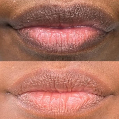 Nuvira Dark Lips Brightening Cream, Lip Lightening for Dark Lips, Nuvira Dark Lip Cream, Nuvira for Dark Lips, Lip Balm for Dark Lips Treatment for Smokers, Lip Exfoliator Softening & Hydration (1 pc)