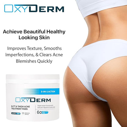 Butt & thigh Acne Treatment Pads - Exfoliating Pads to Eliminate Acne Causing Bacteria. Removes Pimples, Blemishes & Ingrown Hairs for the Buttocks & Thigh Area for Both Men & Women.