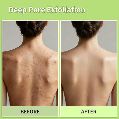 Korean Exfoliating Mitt & Glove Set, 4-Pack Exfoliating Bath Towels and 2-Pack Bath Gloves in Green & Yellow for Deep Dead Skin Removal, Smooth Skin and Spa-Like Experience,