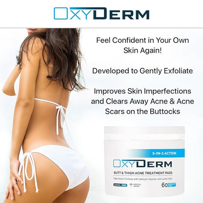 Butt & thigh Acne Treatment Pads - Exfoliating Pads to Eliminate Acne Causing Bacteria. Removes Pimples, Blemishes & Ingrown Hairs for the Buttocks & Thigh Area for Both Men & Women.