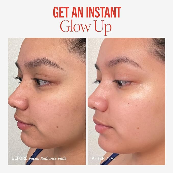 First Aid Beauty - Facial Radiance Pads with Glycolic & Lactic Acids, Daily Exfoliating Pads with AHA, Visibly Smaller Pores, Help Tone & Brighten Skin, One-Step Makeup Prep, Compostable, 60