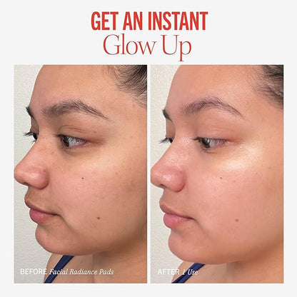 First Aid Beauty - Facial Radiance Pads with Glycolic & Lactic Acids, Daily Exfoliating Pads with AHA, Visibly Smaller Pores, Help Tone & Brighten Skin, One-Step Makeup Prep, Compostable, 28, 3ct