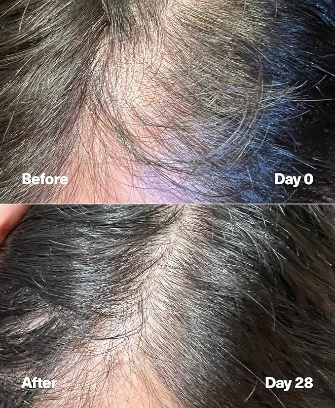 SickScience PowerCycle Exosome Hair Growth Serum - Clinically Advanced Scalp Treatment for Thinning Hair, Hair Loss Prevention & Regrowth - Lightweight Formula for Women & Men, Without Minoxidil, 60mL