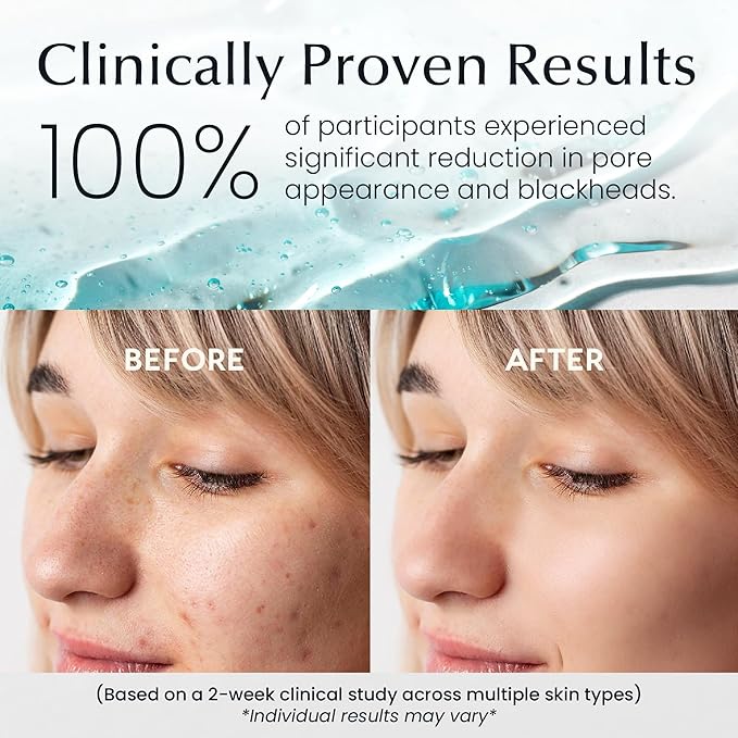 La Pure Korean Toner Pads With Witch Hazel - 100 Ct | Hydrating, Exfoliating Pads & Pore Care Korean Skincare - Gentle, Alcohol-Free, with Glycerin and Centella for Sensitive Skin by La Pure Cosmetics