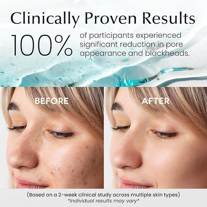 La Pure Korean Toner Pads With Witch Hazel - 100 Ct | Hydrating, Exfoliating Pads & Pore Care Korean Skincare - Gentle, Alcohol-Free, with Glycerin and Centella for Sensitive Skin by La Pure Cosmetics