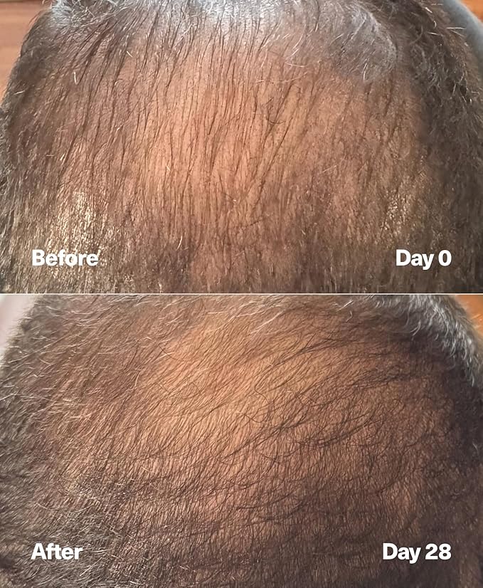 SickScience PowerCycle Exosome Hair Growth Serum - Clinically Advanced Scalp Treatment for Thinning Hair, Hair Loss Prevention & Regrowth - Lightweight Formula for Women & Men, Without Minoxidil, 60mL