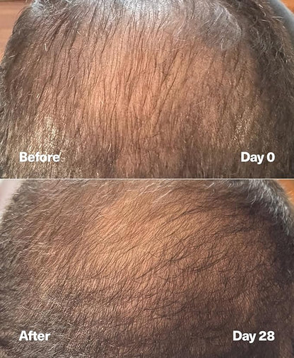 SickScience PowerCycle Exosome Hair Growth Serum - Clinically Advanced Scalp Treatment for Thinning Hair, Hair Loss Prevention & Regrowth - Lightweight Formula for Women & Men, Without Minoxidil, 60mL