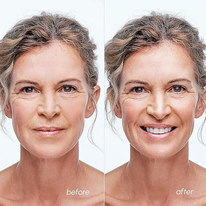 MAREE Blemish Acne Clearing Polishes - Daily Facial Radiance Toner Pads - Witch Hazel Pads Acne Face Toning - Acne Skin Care with BHA Salicylic Acid - Blemish Clearing Witch Hazel Device