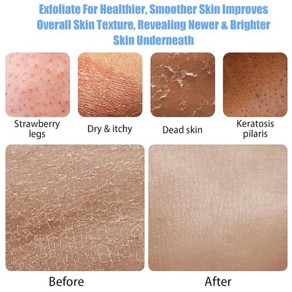 4 Pcs Exfoliating Glove Korean Exfoliating Mitt Body Exfoliator Glove Scrub Gloves Shower Gloves Dead Skin Remover for Body, Self-Tan Prep & Removal, Blue, Green, Black, Pink